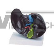 The model of liver and diseased gallbladder